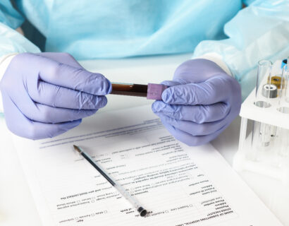 Doctor wearing gloves holds a blood test tube